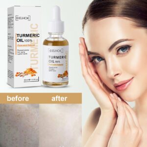 NOORWA Turmeric Dark Spot Corrector Serum